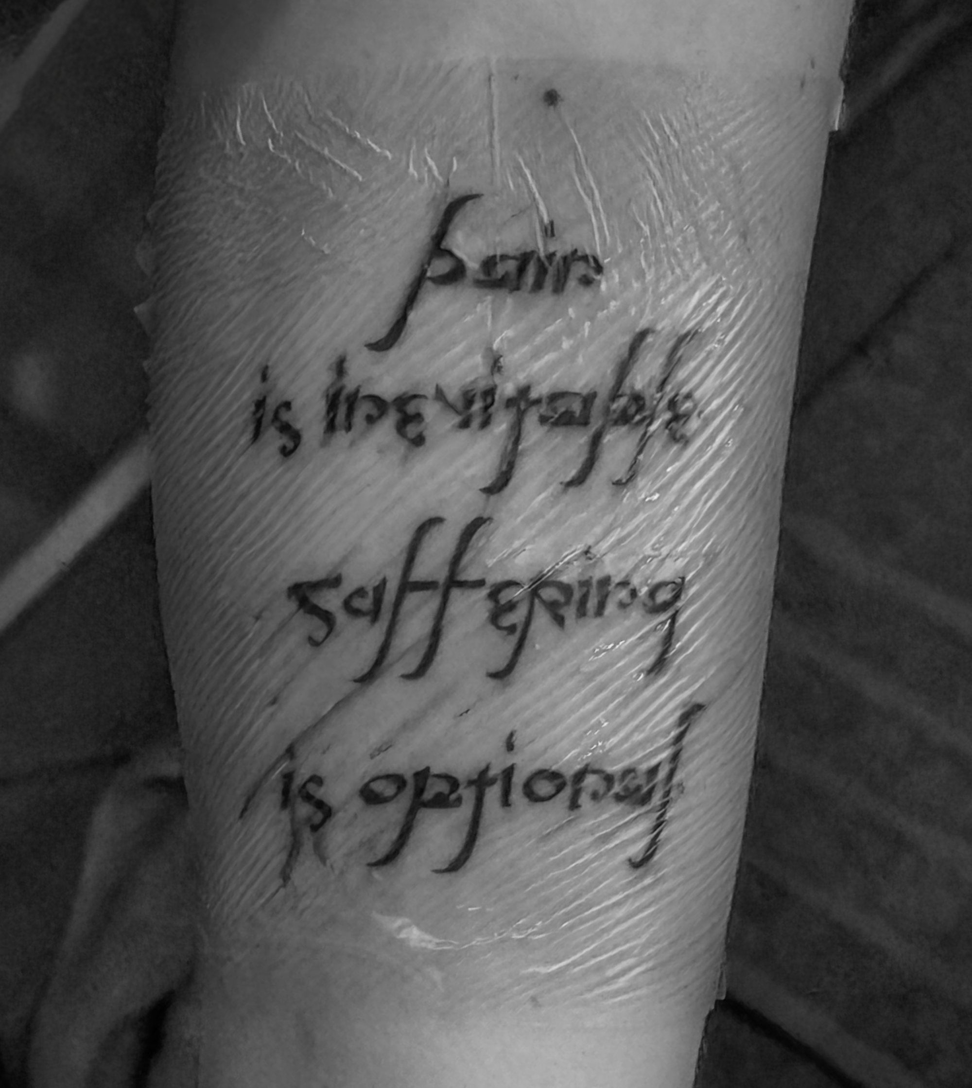 Tattoo before removal — take your time
